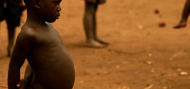 Panorama de la malnutrition dans le monde