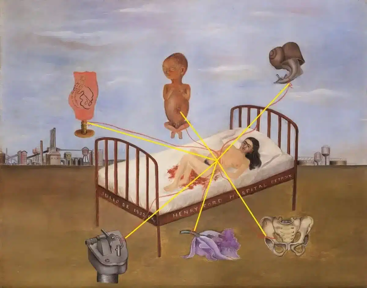 Autoportrait "Henry Ford Hospital" : Frida Kahlo exprime sa douleur physique et émotionnelle